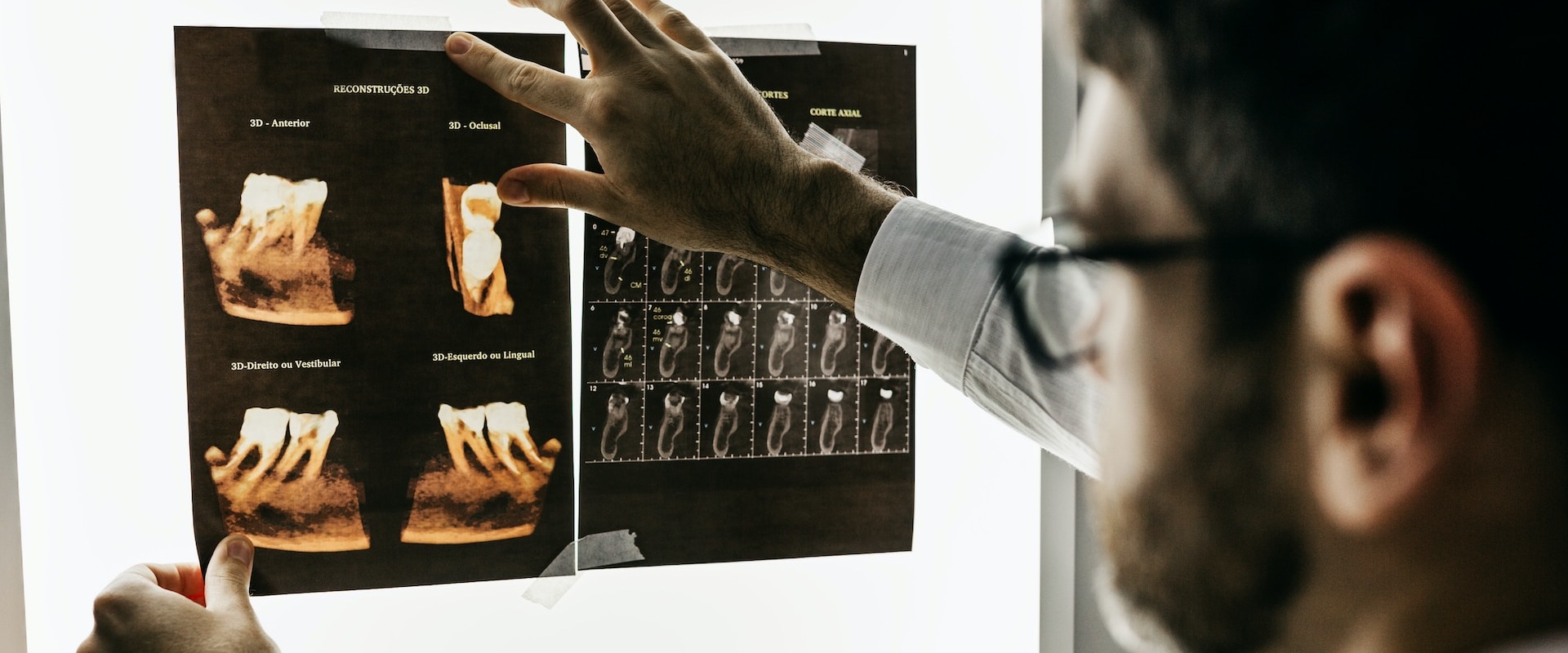 Exploring The Advanced Techniques Of Root Canal Therapy In London's Periodontics