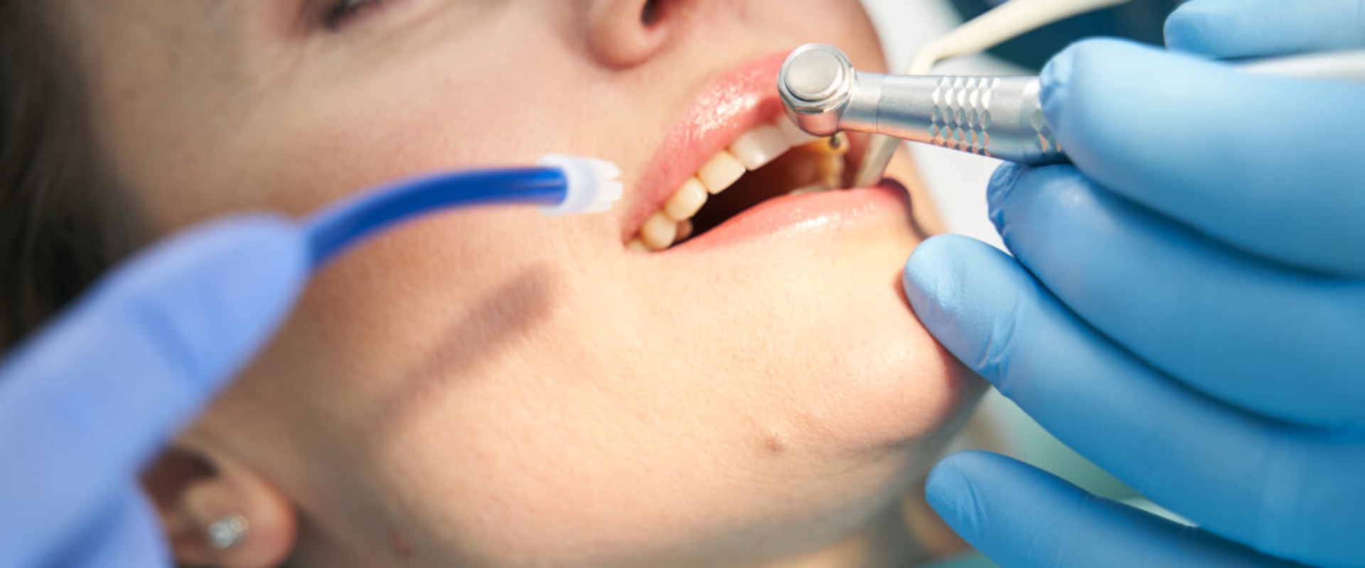 What is the Difference Between Periodontics and General Dentistry?