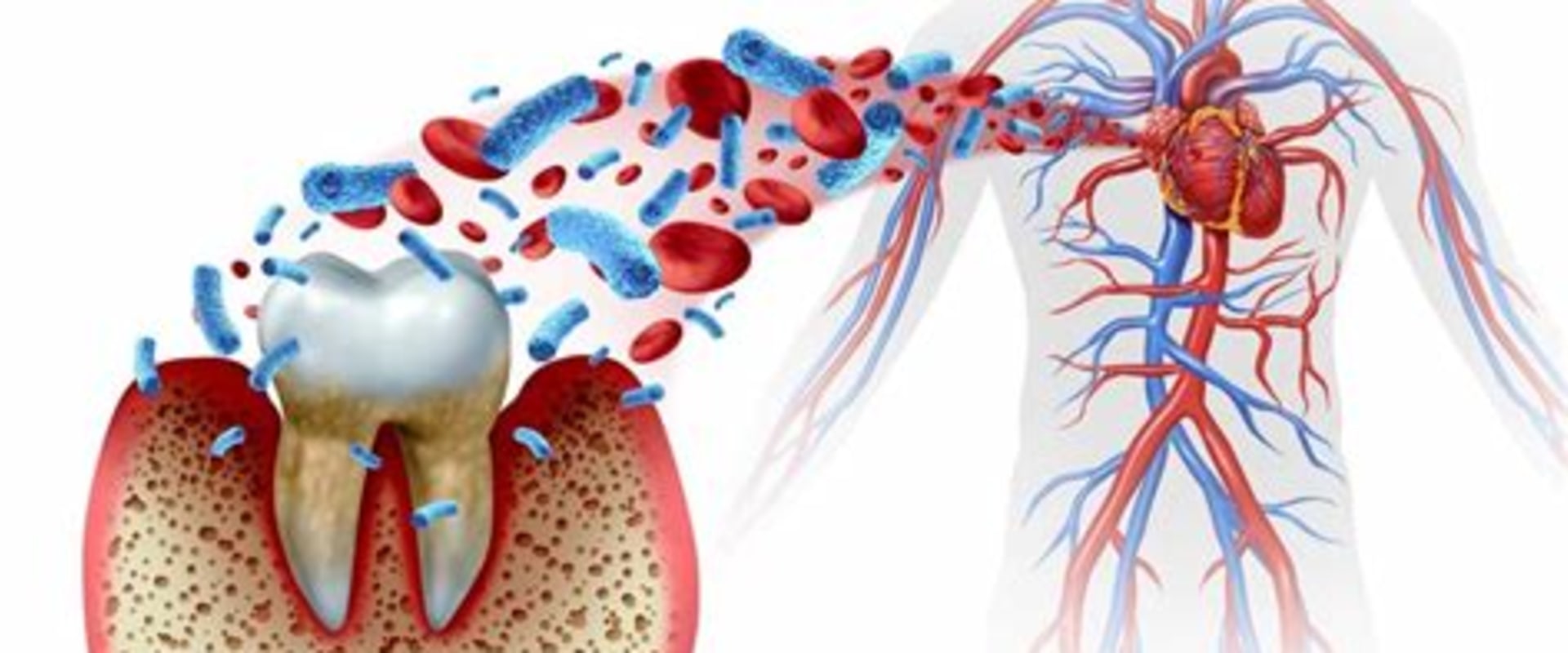 The Hidden Connection Between Inflammation and Periodontal Disease