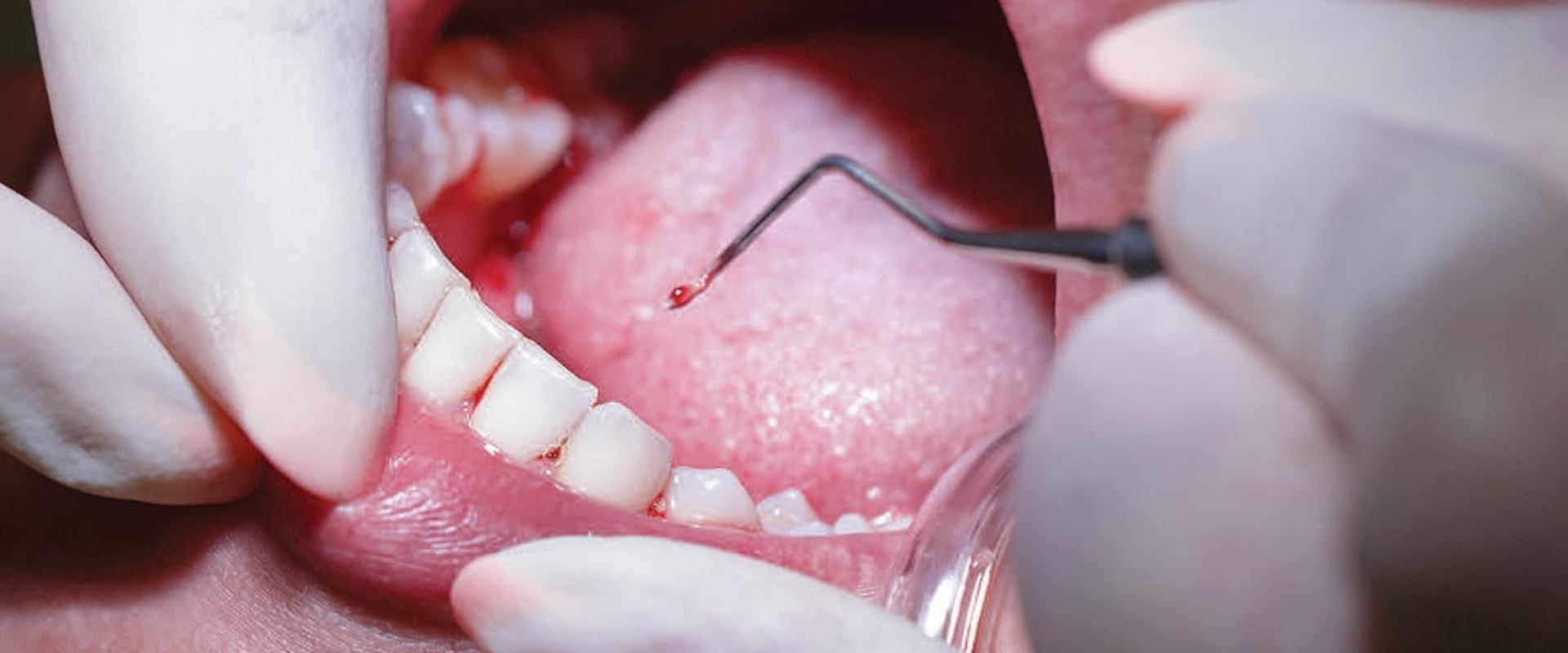 Periodontics: Common Treatments and Procedures