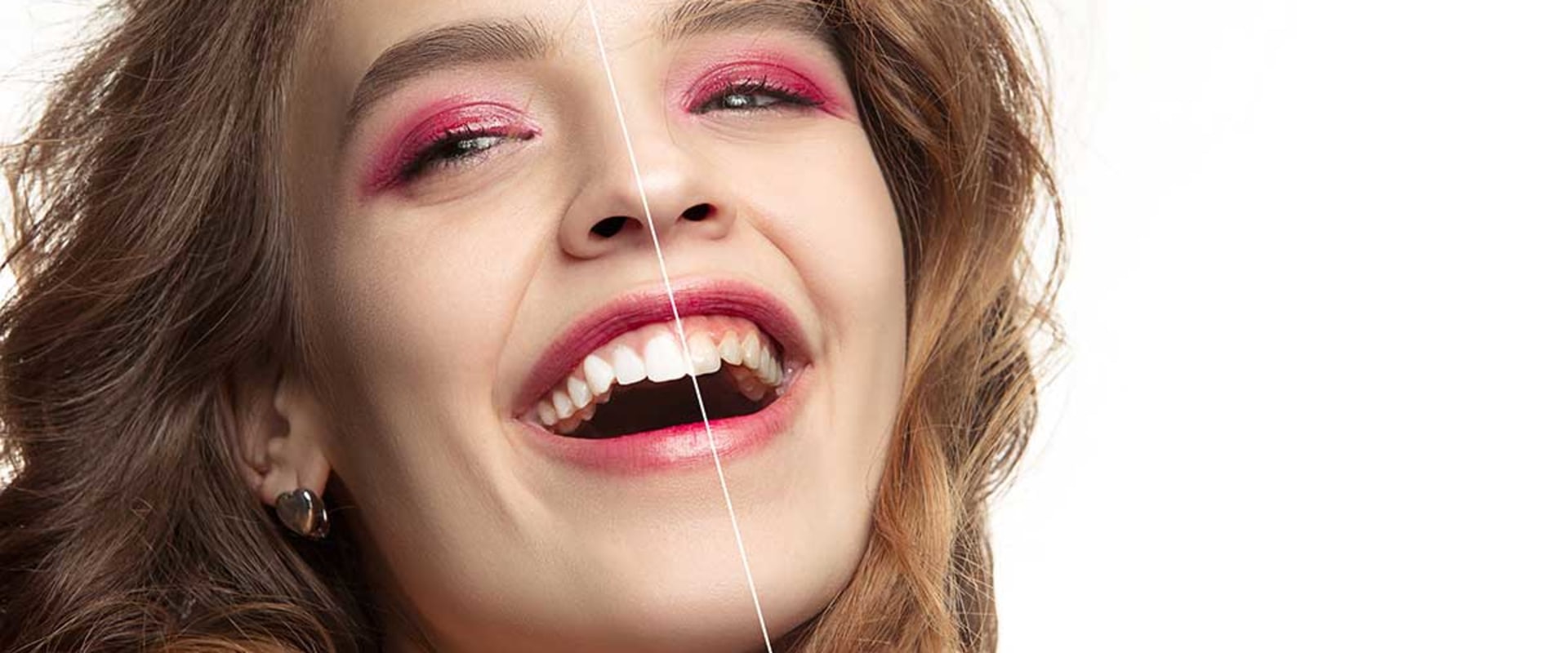 Gum Health Matters: Periodontics In Waco, TX For A Stunning Smile Makeover
