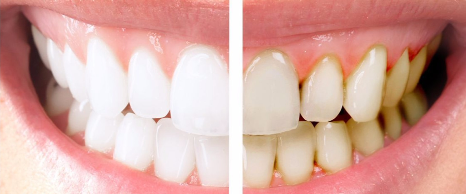 Treating Periodontal Disease: Medications That Can Help