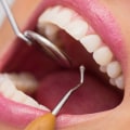 Periodontics: A Comprehensive Guide to Treatments and Procedures