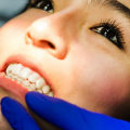 Understanding Periodontics: Exploring The Specialty Of Periodontal Care In Dripping Springs