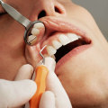 A Solid Foundation: The Importance Of Periodontal Care Before Dental Implants In Pflugerville, TX