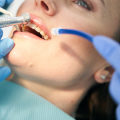 What is the Difference Between Periodontics and General Dentistry?