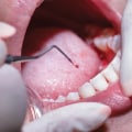 Periodontics: Common Treatments and Procedures