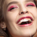 Gum Health Matters: Periodontics In Waco, TX For A Stunning Smile Makeover