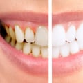 Treating Periodontal Disease: Medications That Can Help