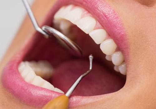 Periodontics: A Comprehensive Guide to Treatments and Procedures