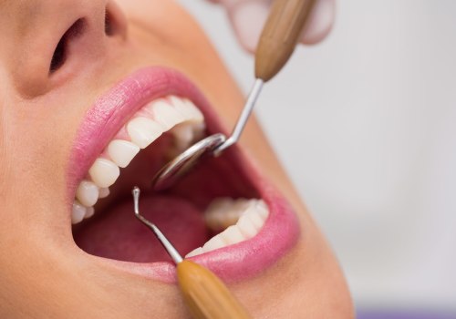 Periodontal Treatments and Procedures: What Do Periodontists Perform?