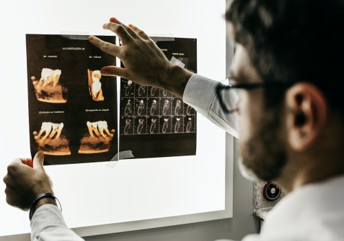 Exploring The Advanced Techniques Of Root Canal Therapy In London's Periodontics