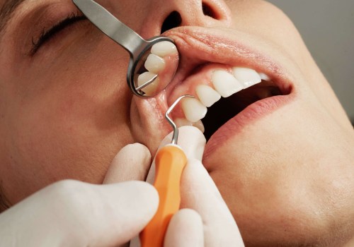 A Solid Foundation: The Importance Of Periodontal Care Before Dental Implants In Pflugerville, TX