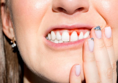 Lifestyle Changes to Combat Periodontal Disease