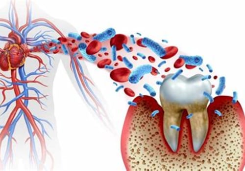 The Hidden Connection Between Inflammation and Periodontal Disease