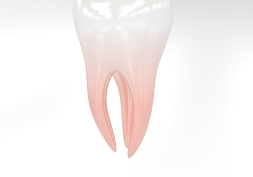 Advanced Solutions for Gum Health and Dental Implants in Kilchberg