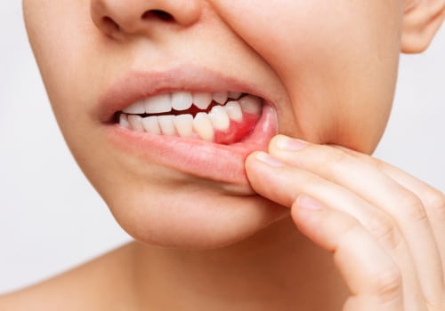 Basel Periodontics: How Dental Care Services Address Gum Disease