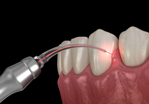 Treating Periodontal Disease: Over-the-Counter Remedies