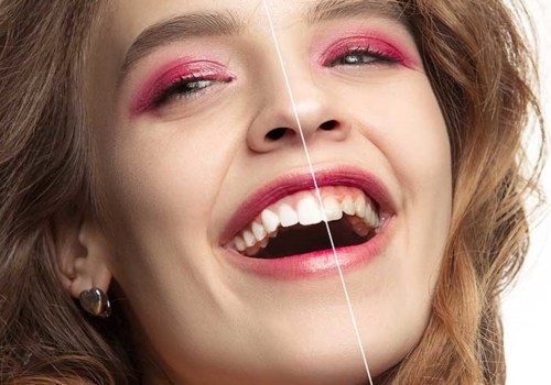 Gum Health Matters: Periodontics In Waco, TX For A Stunning Smile Makeover